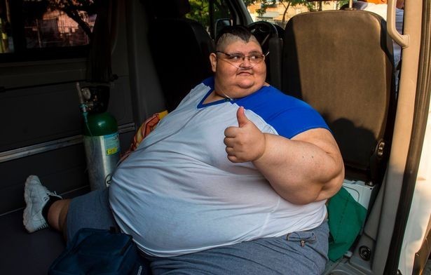 Самому толстому мужчине в мире проведут операцию